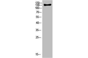 Western Blot analysis of HELA cells using Antibody diluted at 500. (ULK2 抗体  (AA 930-1000))