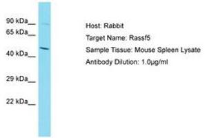 Image no. 1 for anti-Ras Association (RalGDS/AF-6) Domain Family Member 5 (RASSF5) (C-Term) antibody (ABIN6750426) (RASSF5 抗体  (C-Term))