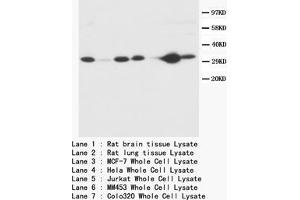 Western blot Caspase-3 (P10) Polyclonal Antibody (Caspase 3 抗体  (C-Term))