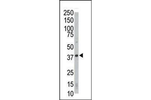 CDK4 抗体  (C-Term)