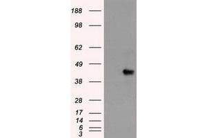 HEK293T cells were transfected with the pCMV6-ENTRY control (Left lane) or pCMV6-ENTRY SOX17 (Right lane) cDNA for 48 hrs and lysed. (SOX17 抗体  (AA 177-414))