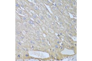 Immunohistochemistry of paraffin-embedded human liver using RPH3AL antibody (ABIN5974449) at dilution of 1/100 (40x lens). (RPH3AL 抗体)