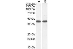 ABIN190834 (0. (ASS1 抗体  (Internal Region))