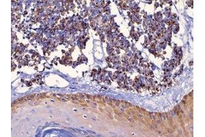 Immunohistochemistry (IHC) image for anti-Keratin 18 (KRT18) (C-Term) antibody (ABIN870573) (Cytokeratin 18 抗体  (C-Term))