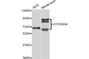 Western blot analysis of extracts of various cell lines, using ATP6V0A4 antibody (ABIN5974639) at 1/1000 dilution. (ATP6V0A4 抗体)