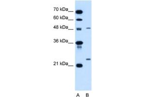 Western Blotting (WB) image for anti-Sphingomyelin phosphodiesterase 2, Neutral Membrane (Neutral Sphingomyelinase) (SMPD2) antibody (ABIN2462850) (SMPD2 抗体)