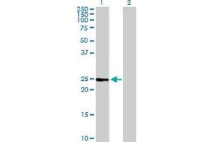 Western Blot analysis of IL6 expression in transfected 293T cell line by IL6 MaxPab polyclonal antibody. (IL-6 抗体  (AA 1-212))