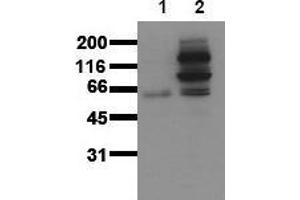 Western Blotting (WB) image for anti-Catenin (Cadherin-Associated Protein), beta 1, 88kDa (CTNNB1) (pTyr654) antibody (ABIN126742) (CTNNB1 抗体  (pTyr654))