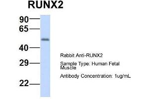 Host:  Rabbit  Target Name:  RUNX2  Sample Type:  Human Fetal Muscle  Antibody Dilution:  1. (RUNX2 抗体  (N-Term))