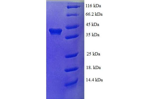 RBM9 Protein (AA 1-380) (His tag)