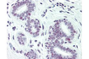 Anti-PAX2 antibody IHC of human breast. (PAX2A 抗体  (pSer393))