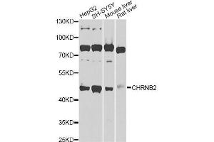 Western blot analysis of extracts of various cell lines, using CHRNB2 Antibody (ABIN6003540) at 1/1000 dilution. (CHRNB2 抗体)