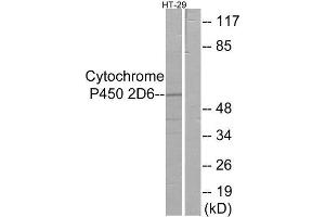 Western Blotting (WB) image for anti-Cytochrome P450, Family 2, Subfamily D, Polypeptide 6 (CYP2D6) (Internal Region) antibody (ABIN1850357) (CYP2D6 抗体  (Internal Region))