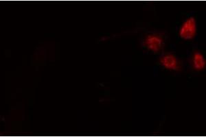 ABIN6274204 staining HepG2 cells by IF/ICC. (NFYA 抗体  (C-Term))