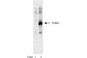 Western blot using anti-HA tag antibody  and HEK293 cells expressing HA-tagged Rem protein at 1:1000 dilution. (HA-Tag 抗体)