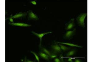 Immunofluorescence of purified MaxPab antibody to S100A7 on HeLa cell. (S100A7 抗体  (AA 1-101))