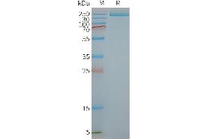 Human R1-Nanodisc, Flag Tag on SDS-PAGE (PLA2R1 蛋白)