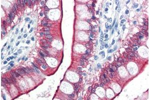 Human Small Intestine (formalin-fixed, paraffin-embedded) stained with VIL1 antibody ABIN337303 at 10 ug/ml followed by biotinylated anti-mouse IgG secondary antibody ABIN481714, alkaline phosphatase-streptavidin and chromogen. (VILL 抗体)