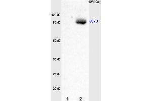 L1 rat kidney lysates L2 rat brain lysates probed with Anti Smoothened/SMO Polyclonal Antibody, Unconjugated (ABIN680908) at 1:200 overnight at 4 °C. (SMO 抗体  (AA 551-650))