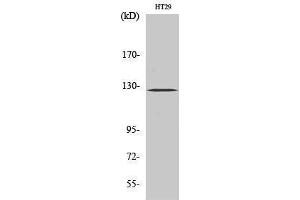 Western Blotting (WB) image for anti-PTK2 Protein tyrosine Kinase 2 (PTK2) (Thr444) antibody (ABIN3180043) (FAK 抗体  (Thr444))