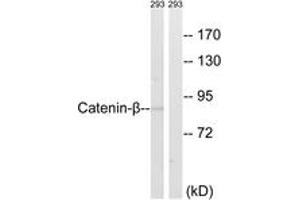 Western blot analysis of extracts from 293 cells, using Catenin-beta (Ab-489) Antibody. (beta Catenin 抗体  (AA 455-504))