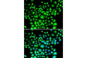 Immunofluorescence analysis of U2OS cells using BCAP31 antibody (ABIN5974244). (BCAP31 抗体)