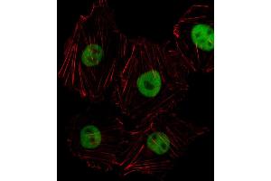 Immunofluorescence (IF) image for anti-Homeobox D8 (HOXD8) (AA 243-270), (C-Term) antibody (ABIN1536919)