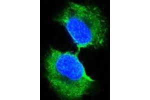 Confocal immunofluorescence analysis of PC-3 cells using GSTP1 antibody (green). (GSTP1 抗体)
