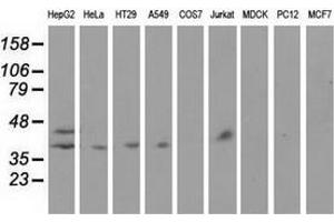 Western blot analysis of extracts (35 µg) from 9 different cell lines by using anti-HP monoclonal antibody. (Haptoglobin 抗体)