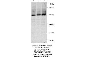 Image no. 1 for anti-Latency-Associated Nuclear Antigen 2 (LANA2) antibody (ABIN363228) (Latency-Associated Nuclear Antigen 2 (LANA2) 抗体)