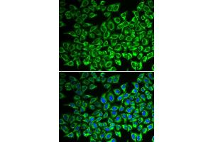 Immunofluorescence (IF) image for anti-Interleukin 12 Receptor beta 1 (IL12RB1) antibody (ABIN1980210) (IL12RB1 抗体)