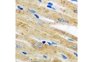 Immunohistochemical analysis of AKR7A2 staining in mouse heart formalin fixed paraffin embedded tissue section. (AKR7A2 抗体)