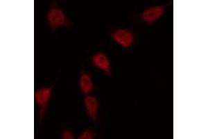 ABIN6269401 staining Hela by IF/ICC. (RPS6KB2 抗体  (C-Term))