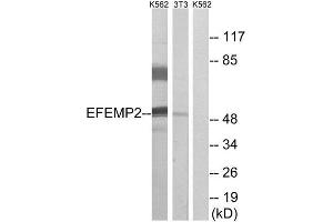 Western Blotting (WB) image for anti-Fibulin 4 (FBLN4) (Internal Region) antibody (ABIN1851283) (FBLN4 抗体  (Internal Region))