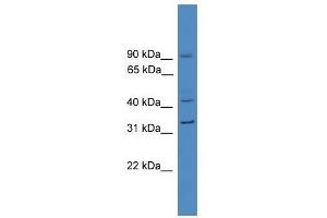 Western Blot showing SERPINE1 antibody used at a concentration of 1-2 ug/ml to detect its target protein. (PAI1 抗体  (N-Term))