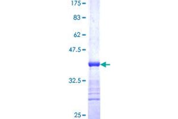 Activin A Receptor Type IB/ALK-4 Protein (AA 24-126) (GST tag)