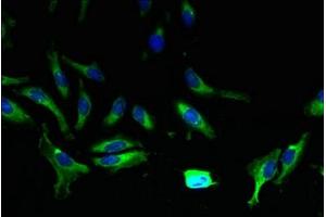 Immunofluorescent analysis of Hela cells using ABIN7144885 at dilution of 1:100 and Alexa Fluor 488-congugated AffiniPure Goat Anti-Rabbit IgG(H+L) (ABCA9 抗体  (AA 106-220))