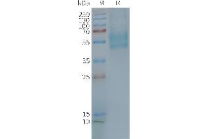 Human F2RL3-Nanodisc, Flag Tag on SDS-PAGE (F2RL3 蛋白)