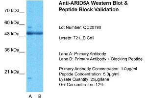 721_B; Host: Rabbit. (ARID5A 抗体  (N-Term))