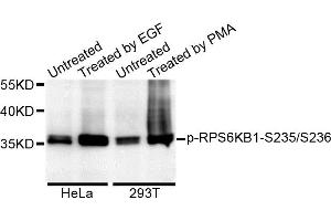 Western blot analysis of extracts of various cell lines, using Phospho-RPS6KB1-S235/236 antibody. (RPS6KB1 抗体)