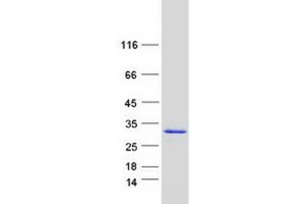 ALKBH7 Protein (Myc-DYKDDDDK Tag)