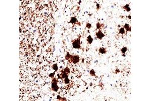 IHC staining of human brain with PGP9. (UCHL1 抗体)