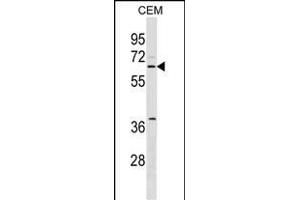 SPS2L Antibody (N-term) (ABIN1539463 and ABIN2849719) western blot analysis in CEM cell line lysates (35 μg/lane). (SPATS2L 抗体  (N-Term))
