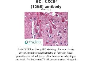 Image no. 1 for anti-Chemokine (C-X-C Motif) Receptor 4 (CXCR4) antibody (ABIN1724035) (CXCR4 抗体)