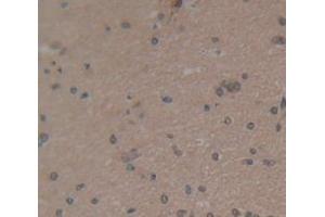 IHC-P analysis of Human Tissue, with DAB staining. (Osteocalcin 抗体  (AA 21-99))