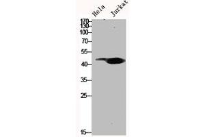 Western Blot analysis of Hela Jurkat cells using MYLIP Polyclonal Antibody (MYLIP 抗体  (Internal Region))