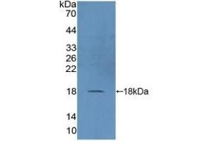 Detection of Recombinant DUSP5, Human using Polyclonal Antibody to Dual Specificity Phosphatase 5 (DUSP5) (DUSP5 抗体  (AA 1-135))