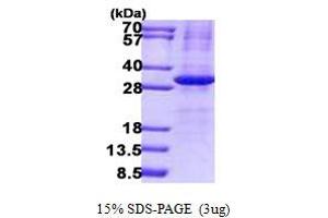 Image no. 1 for Interleukin 34 (IL34) protein (His tag) (ABIN7280173) (IL-34 Protein (His tag))