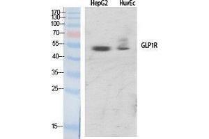 Western Blotting (WB) image for anti-Glucagon-Like Peptide 1 Receptor (GLP1R) (Internal Region) antibody (ABIN3175279) (GLP1R 抗体  (Internal Region))