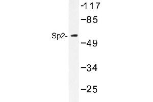 Image no. 1 for anti-Sp2 Transcription Factor (Sp2) antibody (ABIN272208) (Sp2 抗体)